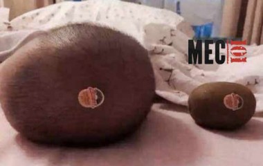 Bébé avec une tête de kiwi